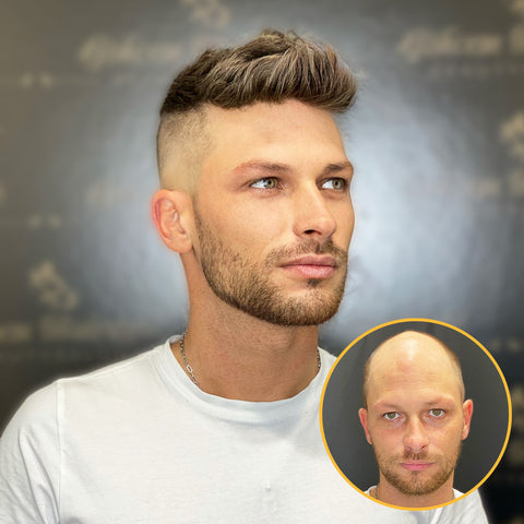 Full Swiss Lace Hair System Realistic Hairline for Men